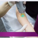 医師または看護師が、施術を行います。 施術時間はご希望の箇所によって異なりますが、 15分~2時間程度です。